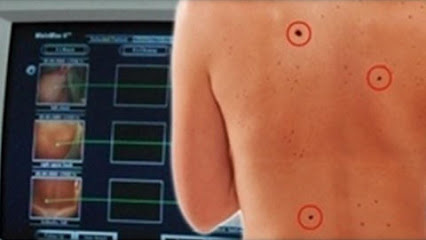 Santini Dr. Marcello - Dermatologo